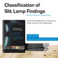 “Classification of Slit Lamp Findings” The practical handbook from Professor Sickenberger is now available in English!